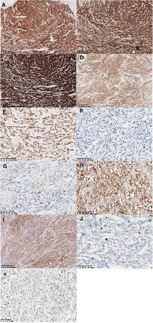 【佳学基因检测】PCR基因评估分析COX6A1基因有突变，如何解读？